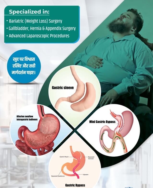  Gastric Bypass Surgery